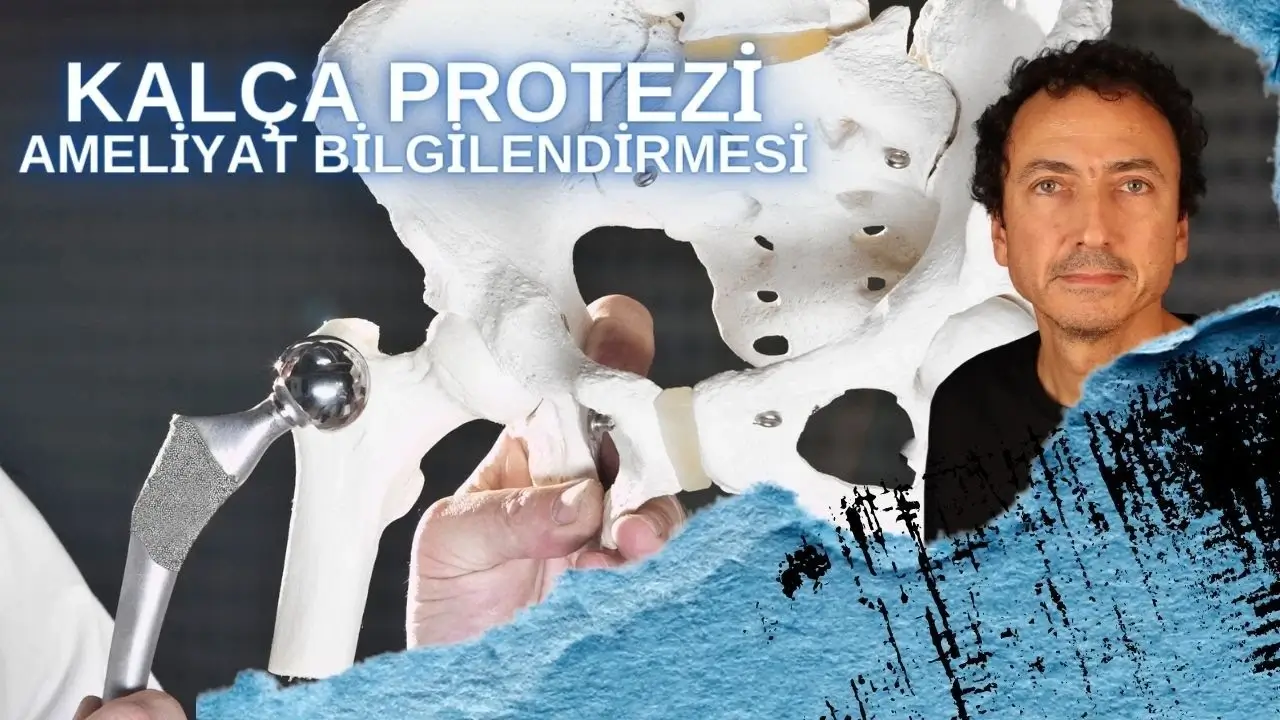 Kalça Protezi / Ameliyat Süreci Bilgilendirmesi