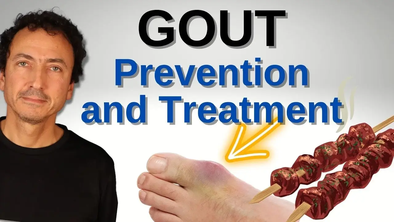 The Truth About Gout: Prevention and Treatment!