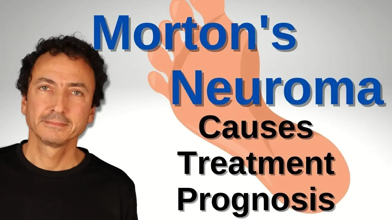 Morton's Neuroma - Causes, Treatment, and Prognosis